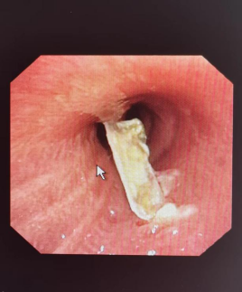 为什么用震动排痰万源市人民医院_https://www.jmylbn.com_新闻资讯_第20张